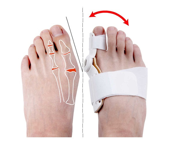 Corrector de férula de juanete 3D 🦶 X 2